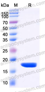 Recombinant Human PIN4 Protein, N-His