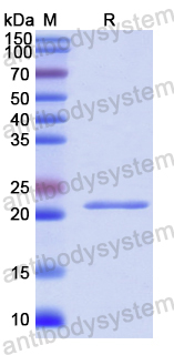 Recombinant Human REXO2 Protein, N-His