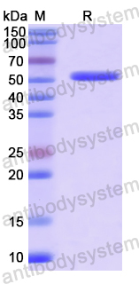 Recombinant Human PRKAB1 Protein, N-GST