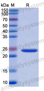 Recombinant Human RAD54L2 Protein, N-His