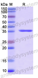 Recombinant Human HYOU1 Protein, N-His