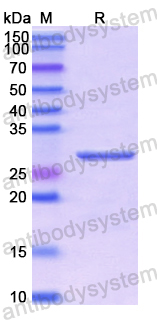 Recombinant Human ANGPTL3 Protein, N-His