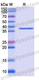 Recombinant Human UCHL5 Protein, N-His