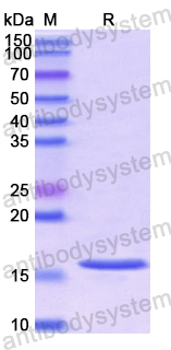 Recombinant Human FADS3 Protein, N-His