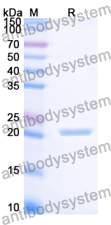 Recombinant Human MMP24 Protein, N-His