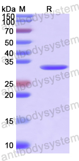 Recombinant Human SPIN1 Protein, N-His