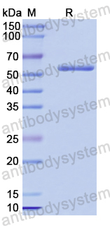 Recombinant Human CYP46A1 Protein, N-His