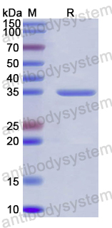 Recombinant Human SIRT4 Protein, N-His