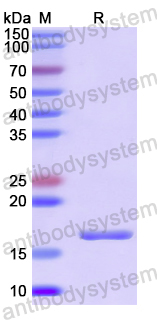 Recombinant Human EPN1 Protein, N-His
