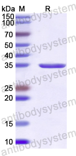 Recombinant Human DNMT3A Protein, N-His