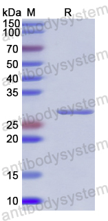Recombinant Human IGF2BP2 Protein, N-His