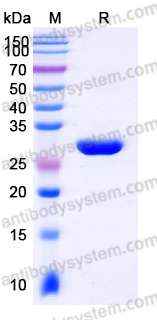 Recombinant Human IGF2BP2 Protein, N-T7 & C-His