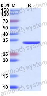 Recombinant Human NCOA3 Protein, N-His