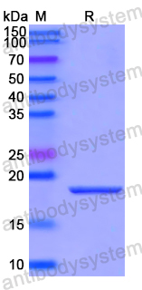 Recombinant Human NUMBL Protein, N-His