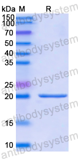 Recombinant Human FCGBP Protein, N-His