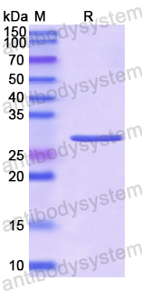 Recombinant Human COLEC10 Protein, N-His