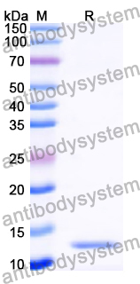 Recombinant Human RNF168 Protein, N-His