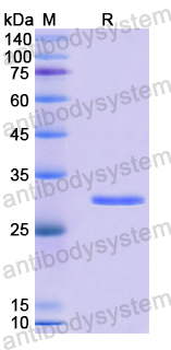 Recombinant Human CFL2 Protein, N-His-SUMO