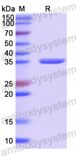 Recombinant Human BHMT Protein, N-His