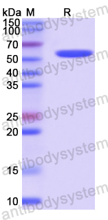 Recombinant Human SCG3 Protein, N-His