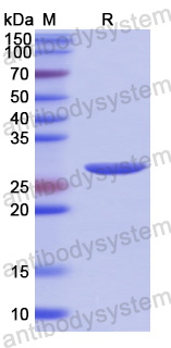 Recombinant Human CPZ Protein, N-His