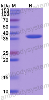 Recombinant Human RIOK1 Protein, N-His