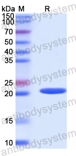 Recombinant Human ACSS1 Protein, N-His