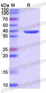 Recombinant Human AASDHPPT Protein, N-His