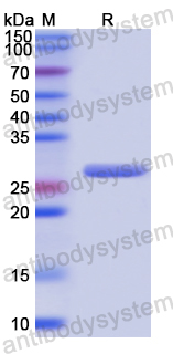 Recombinant Human CPPED1 Protein, N-His