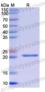 Recombinant Human CNDP1 Protein, N-His