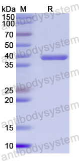 Recombinant Human ANXA10 Protein, N-His