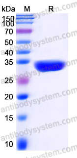 Recombinant Human ANXA10 Protein, Tag free