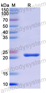 Recombinant Human EMILIN1 Protein, N-His