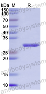 Recombinant Human ERI1 Protein, N-His