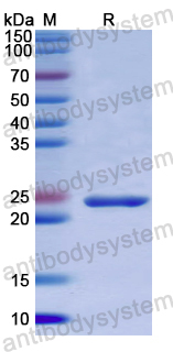 Recombinant Human MTERF1 Protein, N-His
