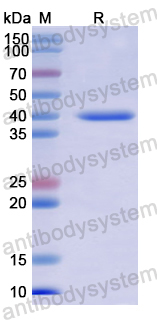 Recombinant Human AZIN2 Protein, N-His