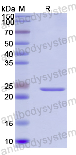 Recombinant Human DPP8 Protein, N-His