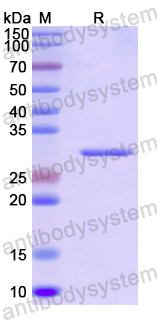 Recombinant Human DTNBP1 Protein, N-His