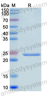 Recombinant Human DPYSL5 Protein, N-His