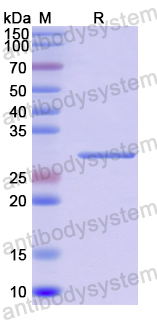Recombinant Human CDC23 Protein, N-His