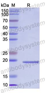 Recombinant Human GREM2 Protein, N-His