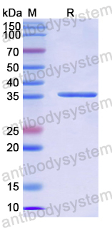 Recombinant Human ACSL6 Protein, N-His