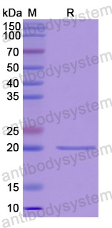 Recombinant Human CAPN7 Protein, N-His