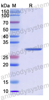 Recombinant Human EARS2 Protein, N-His