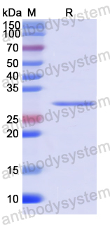 Recombinant Human BAG5 Protein, N-His