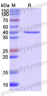 Recombinant Human AMIGO1 Protein, N-His