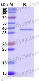 Recombinant Human FBXO3 Protein, N-His