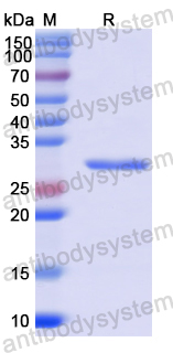 Recombinant Human AP3M1 Protein, N-His