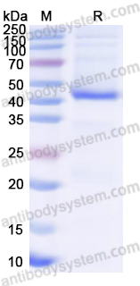 Recombinant Human FBXO2 Protein, N-His