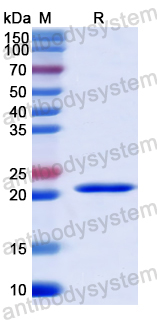 Recombinant Human TASP1 Protein, N-His